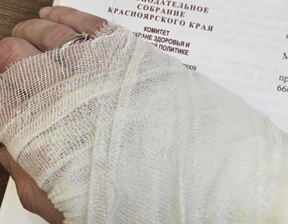 Депутат Красноярска перепутал борщевик с укропом и получил ожоги
